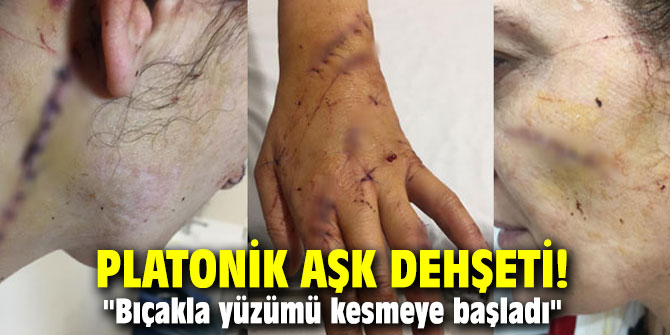 Platonik aşk dehşeti! "Bıçakla yüzümü kesmeye başladı"