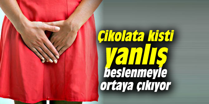 Çikolata kisti yanlış beslenmeyle ortaya çıkıyor