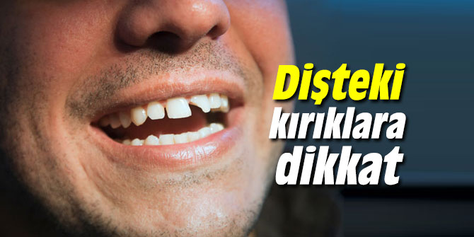 Dişteki kırık problemine dikkat
