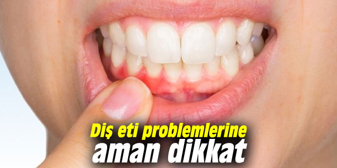 Diş eti problemlerine aman dikkat
