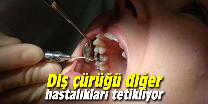 Diş çürüğü diğer hastalıkları tetikliyor