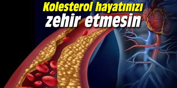 Kolesterol hayatınızı zehir etmesin
