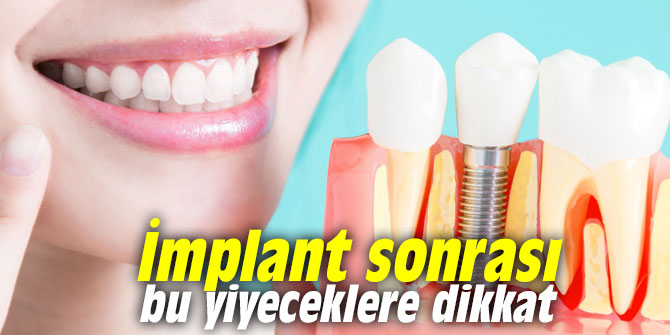 İmplant sonrası bu yiyeceklere dikkat