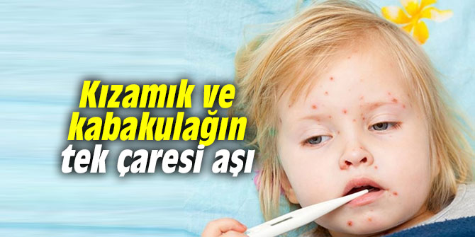 Kızamık ve kabakulağın tek çaresi aşı