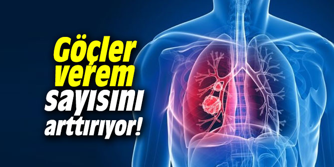 Göçler verem sayısını arttırıyor!