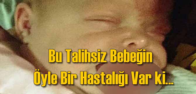 Talihsiz Bebek Öyle Bir Hastalıkla Doğdu ki...