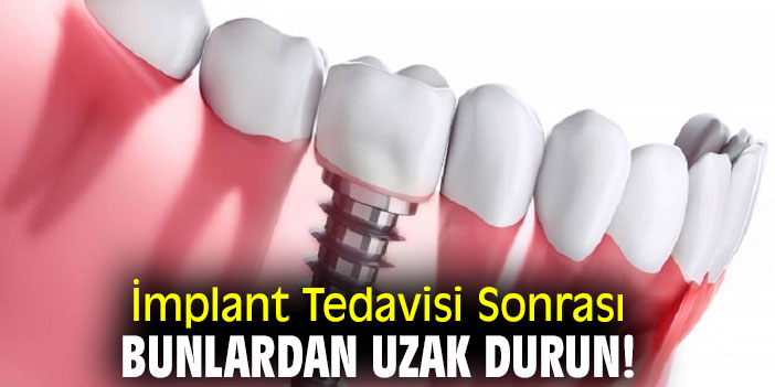 İmplant Tedavisi Sonrası bunlardan uzak durun!