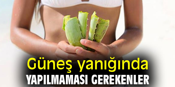 Güneş yanığında yapılmaması gerekenler