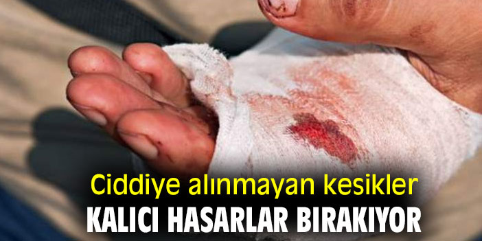 Ciddiye alınmayan kesikler kalıcı hasarlar bırakıyor