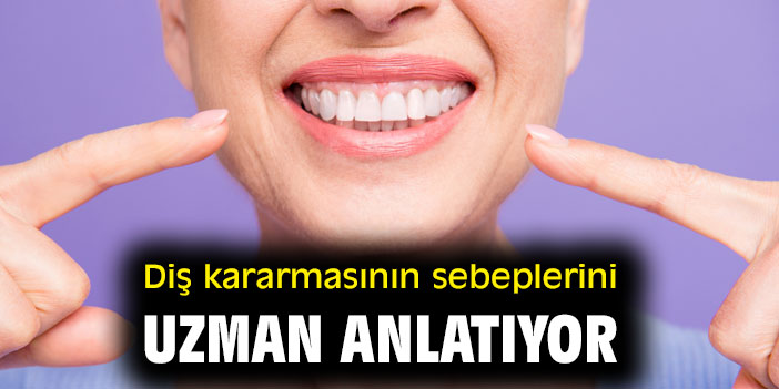 Diş kararmasının sebeplerini uzman anlatıyor