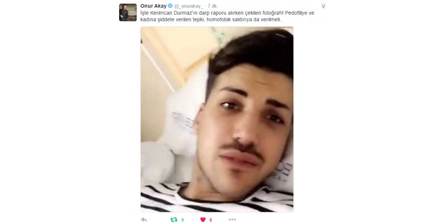 Kerimcan Durmaz'ın yüzünün hali
