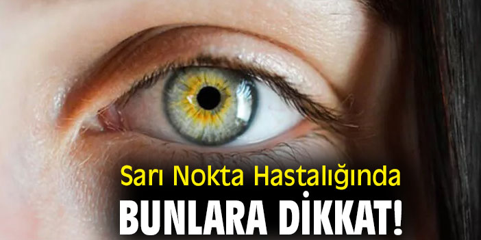 Sarı Nokta Hastalığında bunlara dikkat!