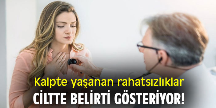 Kalpte yaşanan rahatsızlıklar, ciltte belirti gösteriyor!