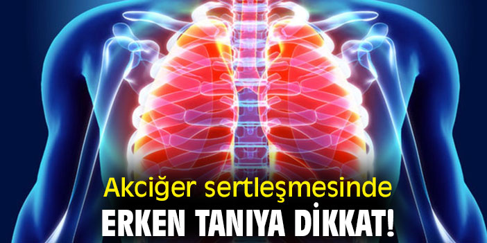 Akciğer sertleşmesinde bunlara dikkat!
