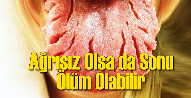 Ağrı Yapmasa da Sonu Ölüm Olabilir
