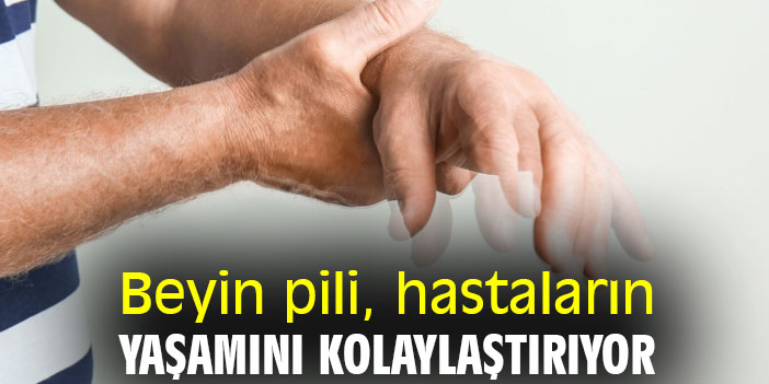 Beyin pili, hastaların yaşamını kolaylaştırıyor