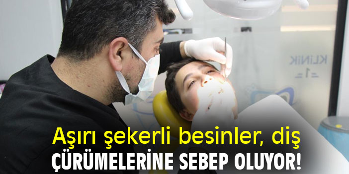 Aşırı şekerli besinler, diş çürümelerine sebep oluyor!