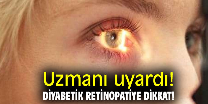 Uzmanı uyardı! Diyabetik retinopatiye dikkat!