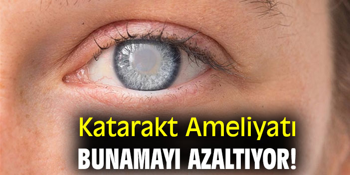 Katarakt Ameliyatı Bunamayı azaltıyor!