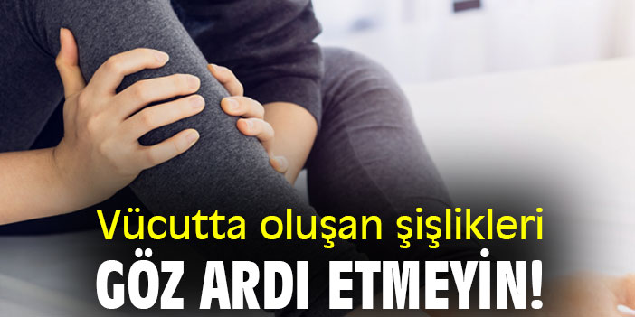 Vücutta oluşan şişlikleri göz ardı etmeyin!