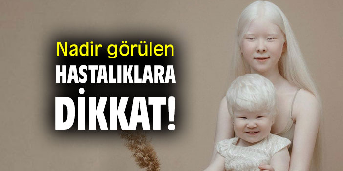 Nadir görülen hastalıklara dikkat!