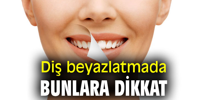Diş beyazlatmada bunlara dikkat