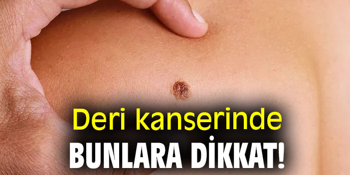 Deri kanserinde bunlara dikkat!