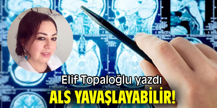 ALS YAVAŞLAYABİLİR!