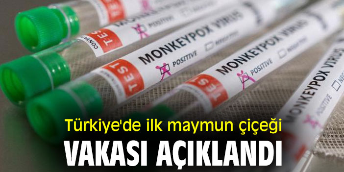 Türkiye'de ilk maymun çiçeği vakası açıklandı