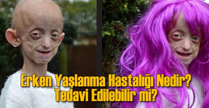 Erken Yaşlanma Hastalığı Nedir? Tedavi Edilebilir mi?