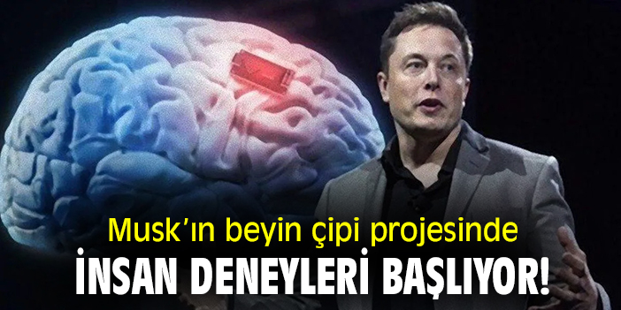 Musk'ın beyin çipi projesinde insan deneyleri başlıyor!