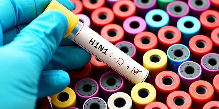 H1N1 virüsü nedir?