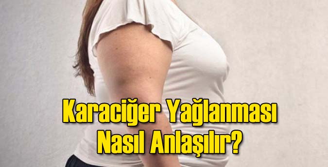Karaciğer Yağlanması Nasıl Anlaşılır?