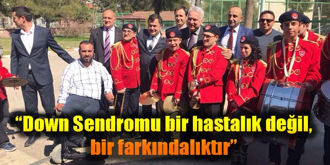 “Down Sendromu bir hastalık değil, bir farkındalıktır”