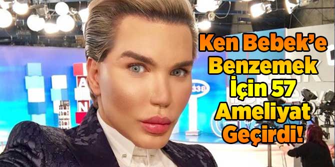 Ken Bebek'e Benzemek İçin 57. Ameliyatını Oldu