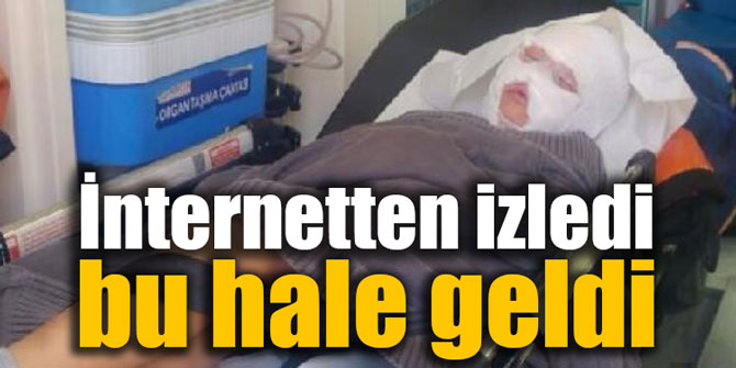 Küçük çocuğu bu hale getiren internetten izlediği video