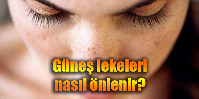 Güneş lekeleri nasıl önlenir?