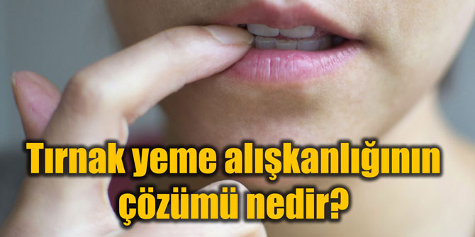Tırnak yeme alışkanlığının çözümü nedir?
