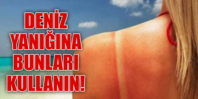 Deniz yanığına bunları kullanın!