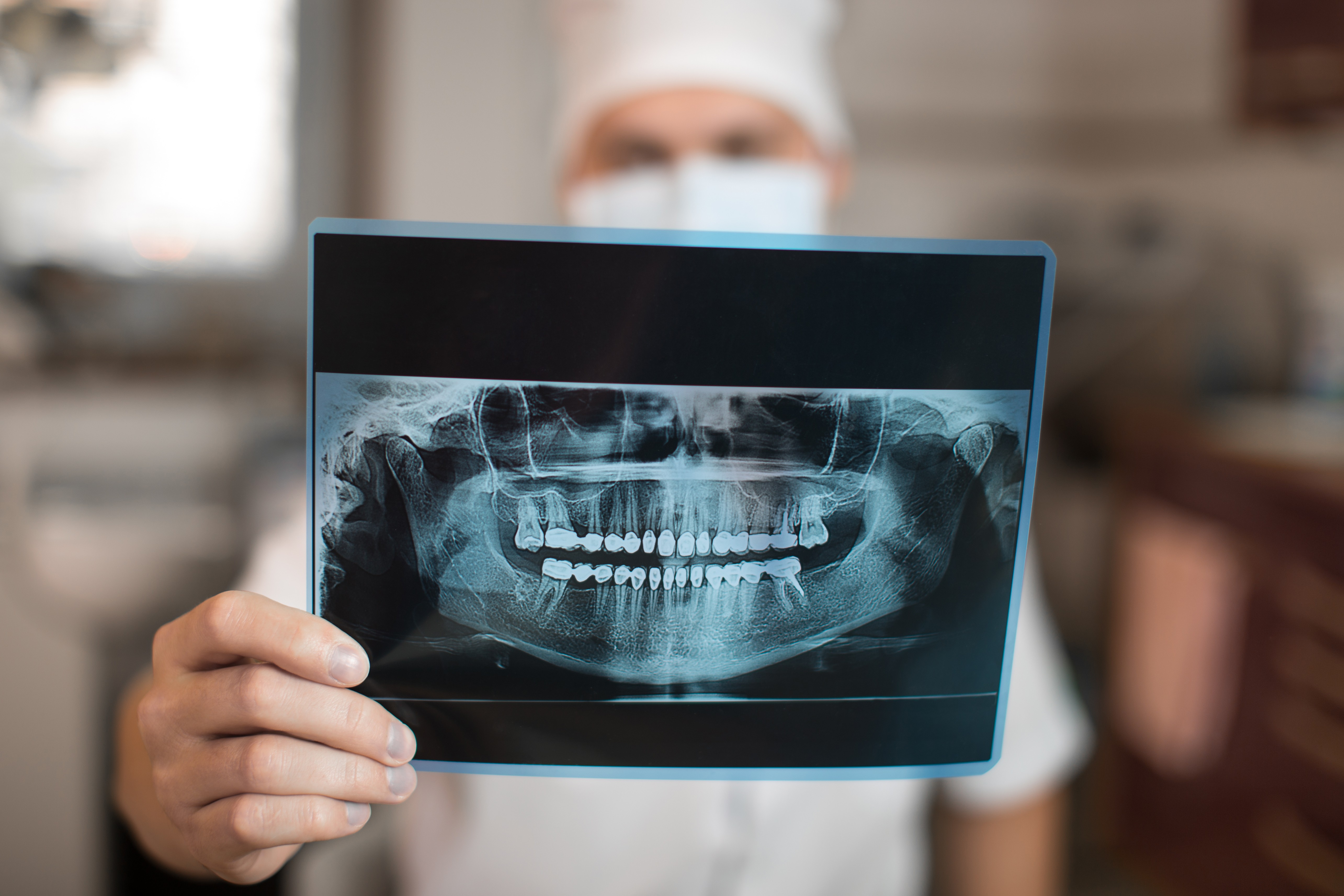 Панорамик рентген зубов