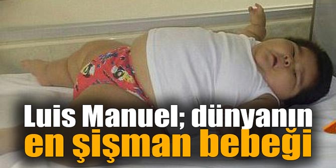 Luis Manuel; dünyanın en şişman bebeği