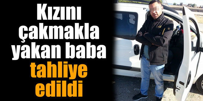 Kızını çakmakla yakan baba tahliye edildi
