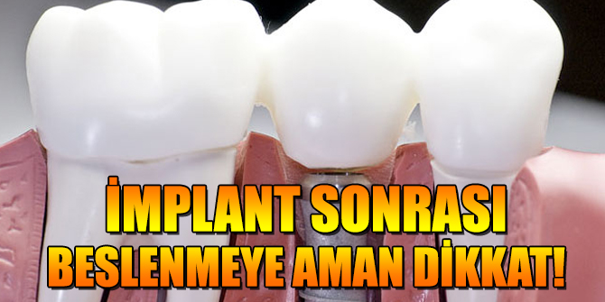 İmplant sonrası beslenmeye aman dikkat