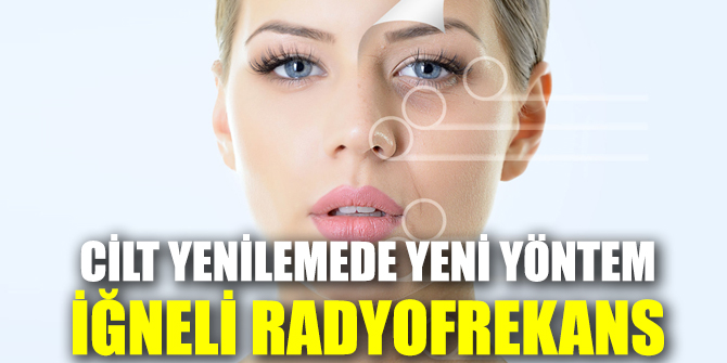 Cilt yenilemede yeni yöntem!