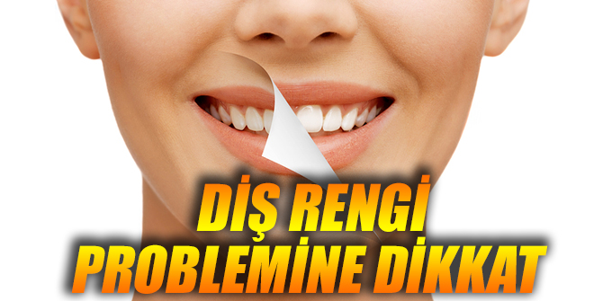 Diş rengine dikkat!