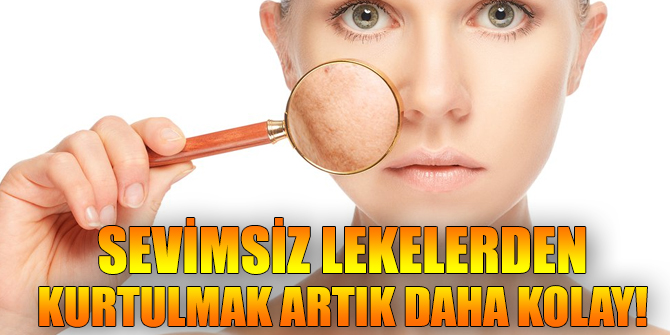 Sevimsiz lekelerden kurtulmak artık daha kolay!