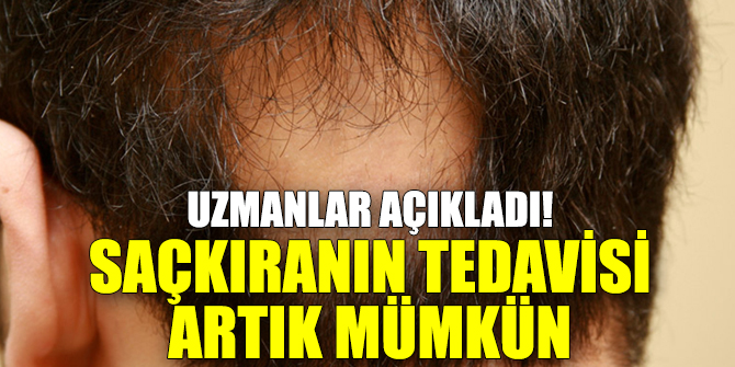 Uzmanlar açıkladı! Saçkıranın tedavisi artık mümkün
