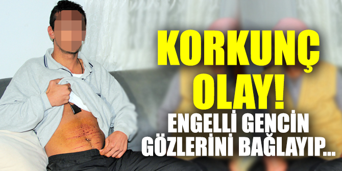 Korkunç olay! Engelli gencin gözlerini bağlayıp işkence ettiler