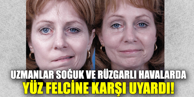 Uzmanlar soğuk ve rüzgarlı havalarda yüz felcine karşı uyardı!