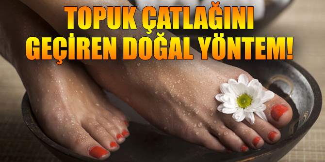 Topuk çatlağını geçiren doğal yöntem!
